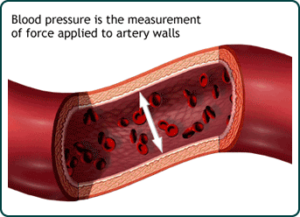 Biomagnetic Pair Therapy for high blood pressure